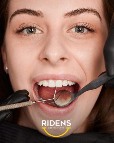RIDENS-mart-03