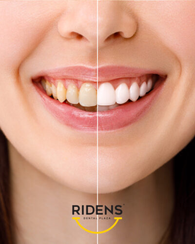 RIDENS-mart-10